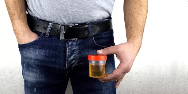 Bactérias na urina podem indicar câncer de próstata agressivo