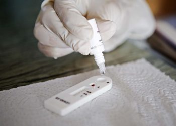 João Pessoa amplia postos de testagem de Covid-19