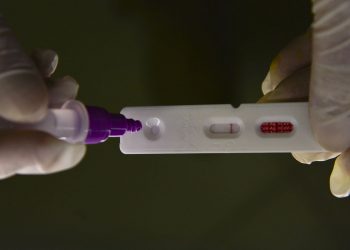 Brasil registra 27.796 casos de covid-19 e 114 mortes em 24 horas