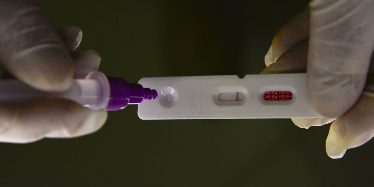 Brasil registra 27.796 casos de covid-19 e 114 mortes em 24 horas