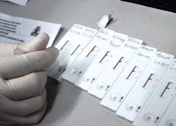 João Pessoa realiza testagem contra Covid-19 no Lacen-JP, Policlínicas Municipais e USFs