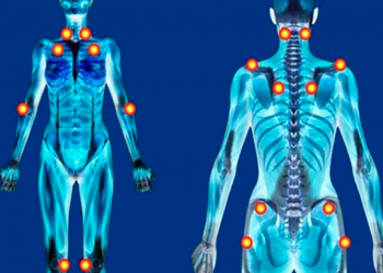 Pessoas com fibromialgia terão os mesmos direitos de deficientes, na PB