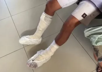 Homem é preso após quebrar as pernas do filho, em João Pessoa